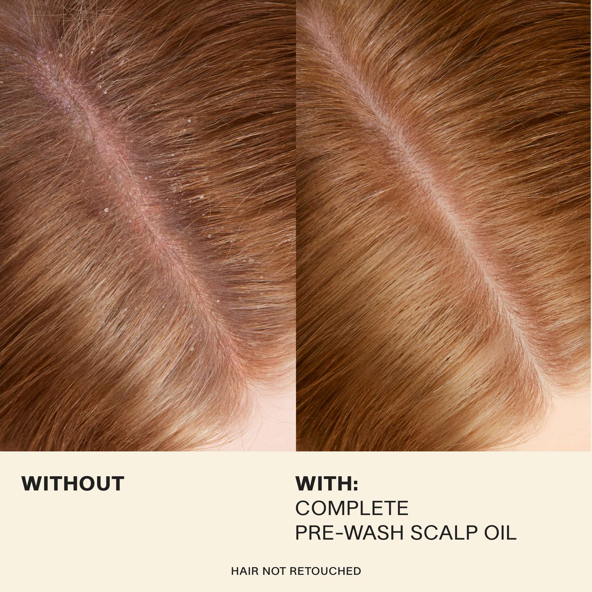 JVN Treatment Complete Pre-Wash Scalp Oil JVN Pre-Wash Scalp Oil | Rosemary-Infused Scalp Treatment sulfate-free silicone-free sustainable